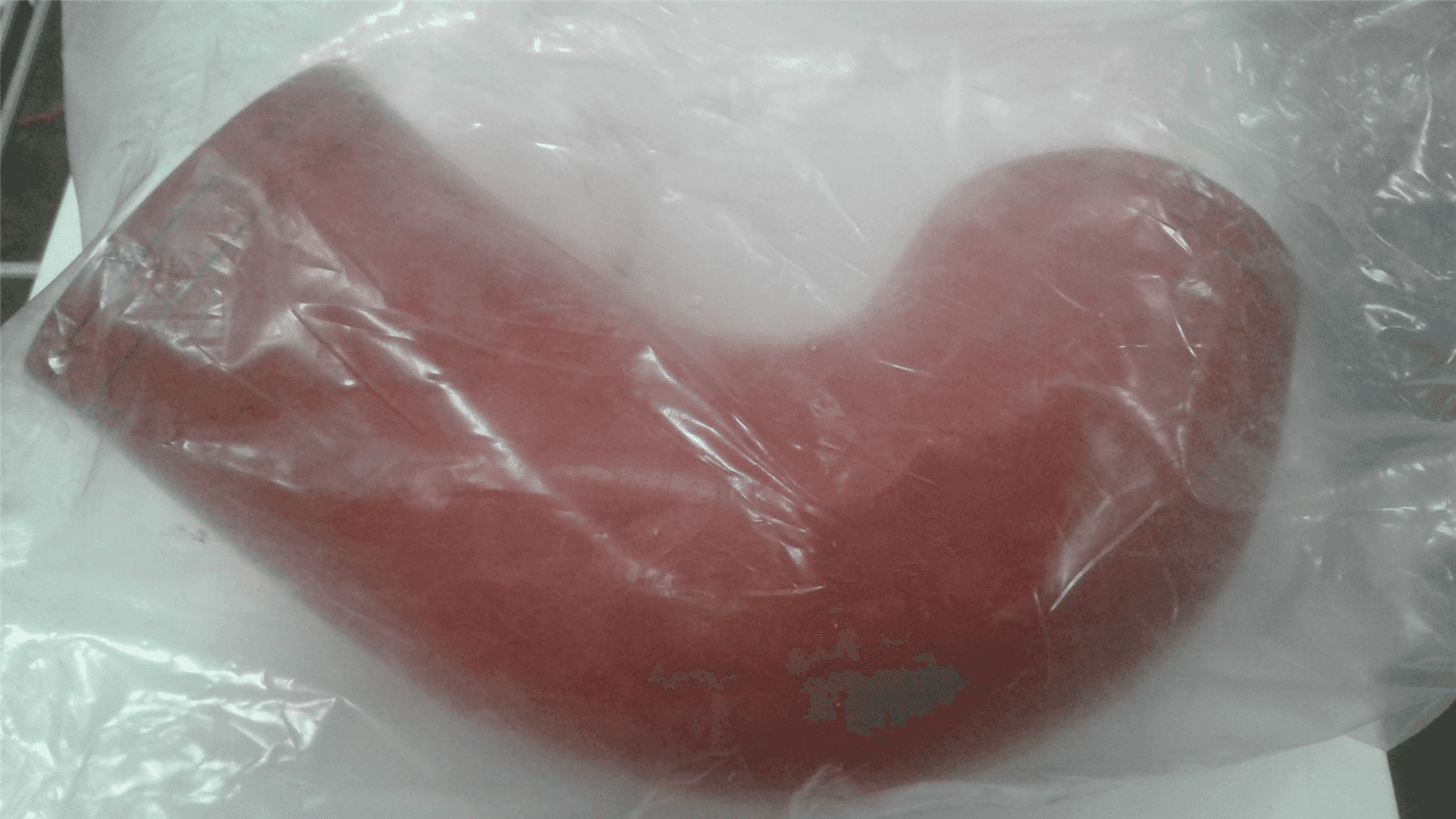 NEW ELBOW indicator image 1